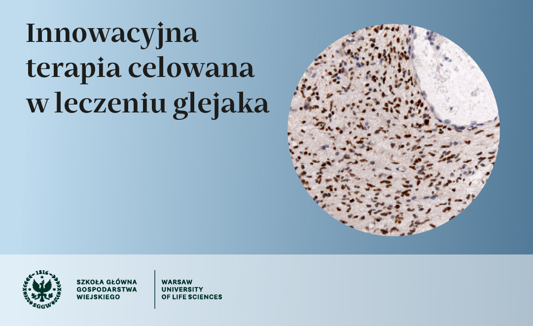 innowacyjna terapia leczenia glejaka